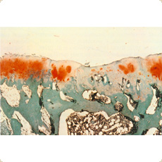 Microscopic picture of hyaline articular cartilage